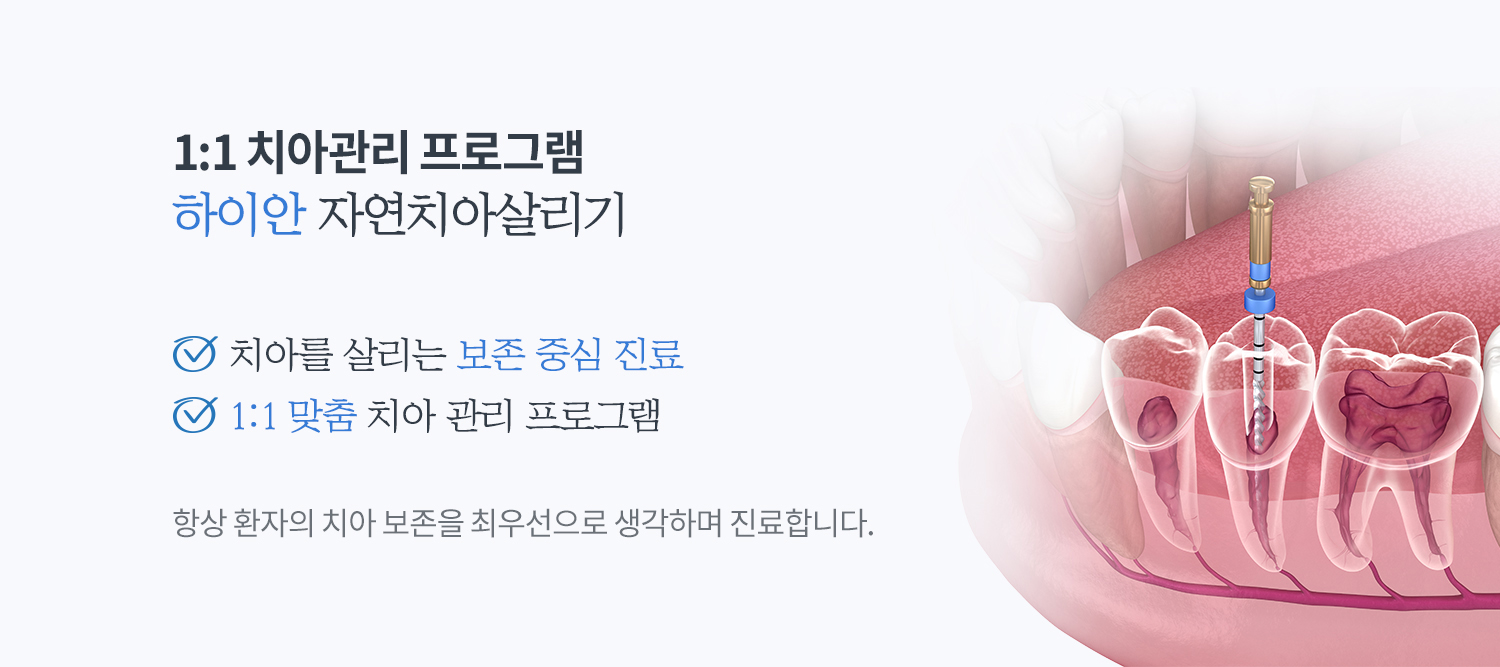 자연치아살리기 진료